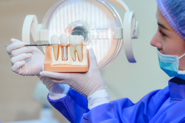 Am I A Candidate For Dental Implants?