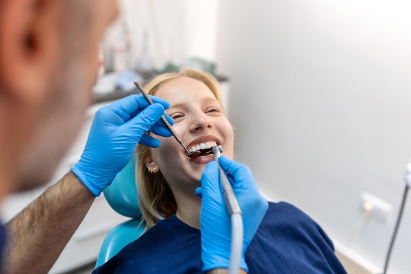 What To Expect When Getting Dental Fillings For Cavities