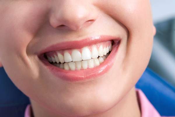 A General Dentist Discusses the Benefits of Tooth Straightening from Relax and Smile Dental Care in Miami, FL