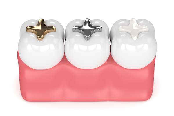 A General Dentist Discusses Different Filling Options from Relax and Smile Dental Care in Miami, FL