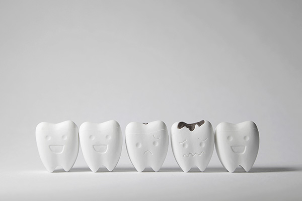 How A General Dentist Can Treat Tooth Decay