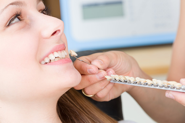 General Dentistry: Can Dental Veneers Help Restore Your Teeth? from Relax and Smile Dental Care in Miami, FL