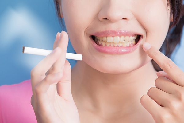 General Dentistry: How Smoking Can Harm Your Teeth from Relax and Smile Dental Care in Miami, FL