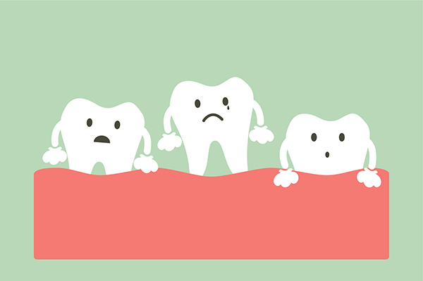 General Dentistry: How To Treat A Loose Tooth