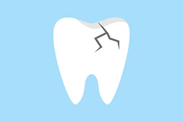 General Dentistry Treatments for a Damaged Tooth from Relax and Smile Dental Care in Miami, FL