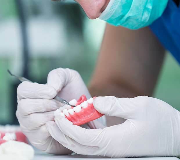 Miami Partial Dentures for Back Teeth