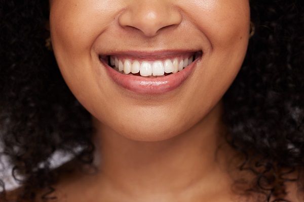 Smile Makeover Options To Improve Your Smile